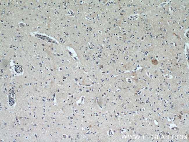 KGA/GAC Antibody in Immunohistochemistry (Paraffin) (IHC (P))