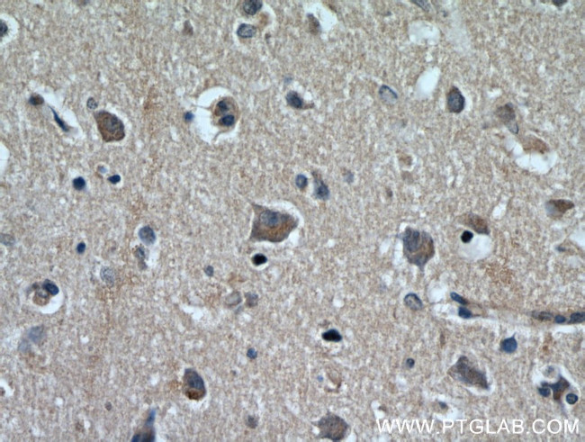 KGA/GAC Antibody in Immunohistochemistry (Paraffin) (IHC (P))