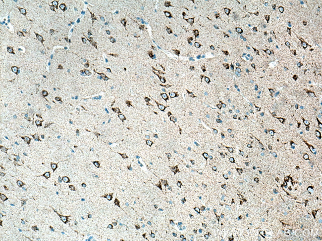 KGA/GAC Antibody in Immunohistochemistry (Paraffin) (IHC (P))