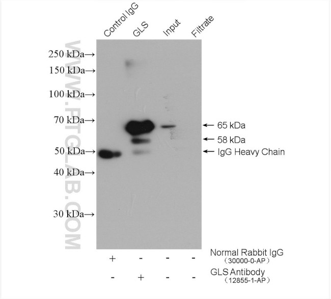 KGA/GAC Antibody in Immunoprecipitation (IP)