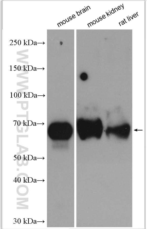 KGA/GAC Antibody in Western Blot (WB)