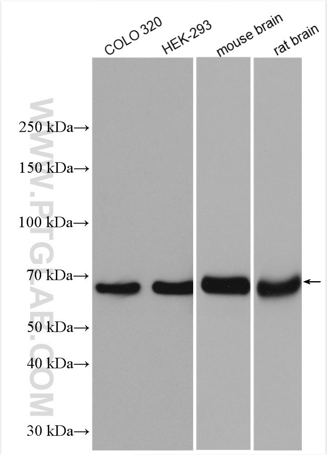 KGA/GAC Antibody in Western Blot (WB)