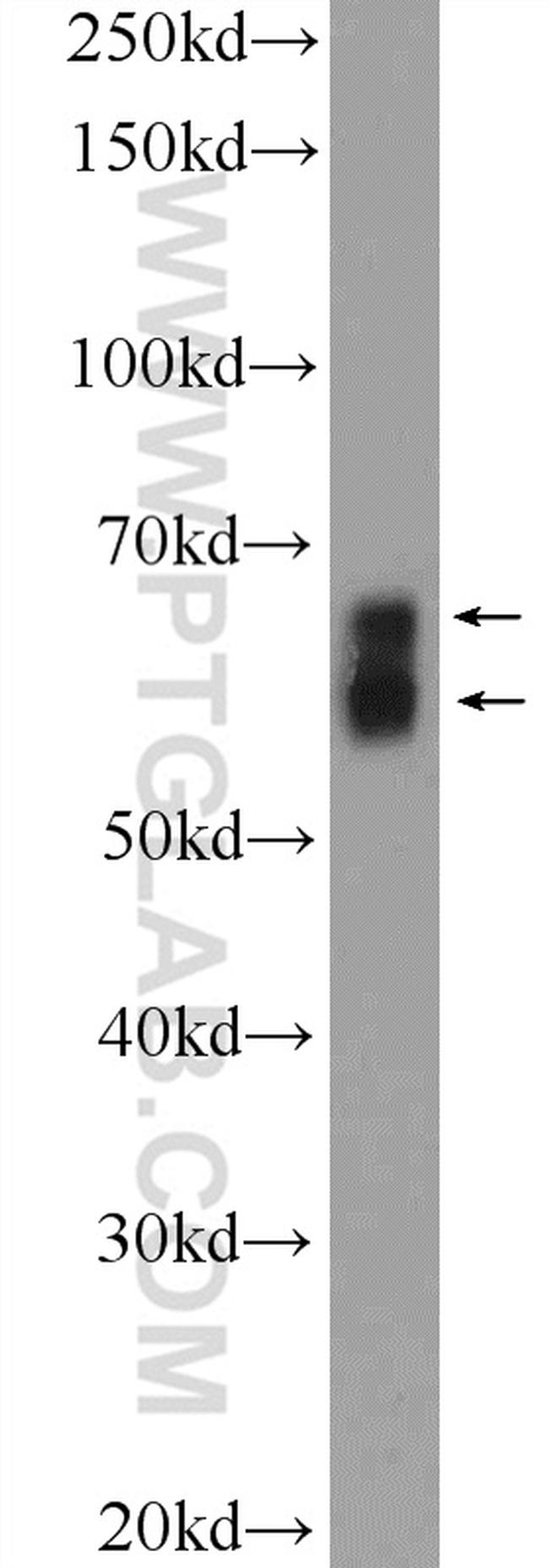 KGA/GAC Antibody in Western Blot (WB)