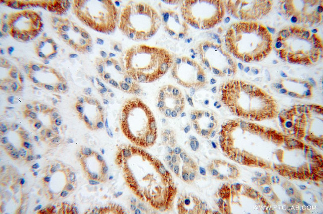 PHYH Antibody in Immunohistochemistry (Paraffin) (IHC (P))