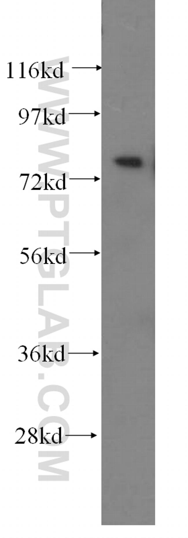 PHYH Antibody in Western Blot (WB)