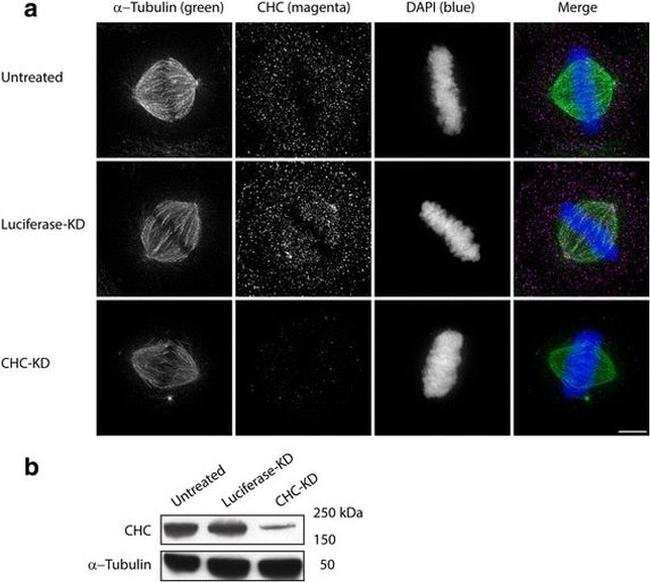 alpha Tubulin Antibody in Immunocytochemistry (ICC/IF)