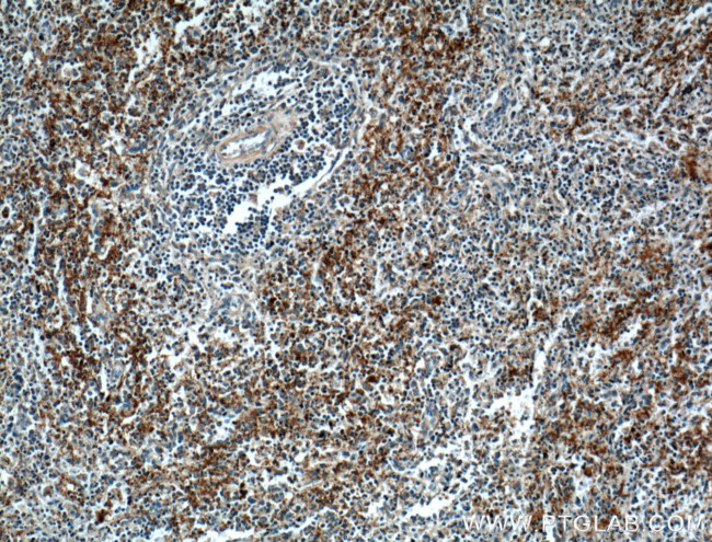 CD42b Antibody in Immunohistochemistry (Paraffin) (IHC (P))