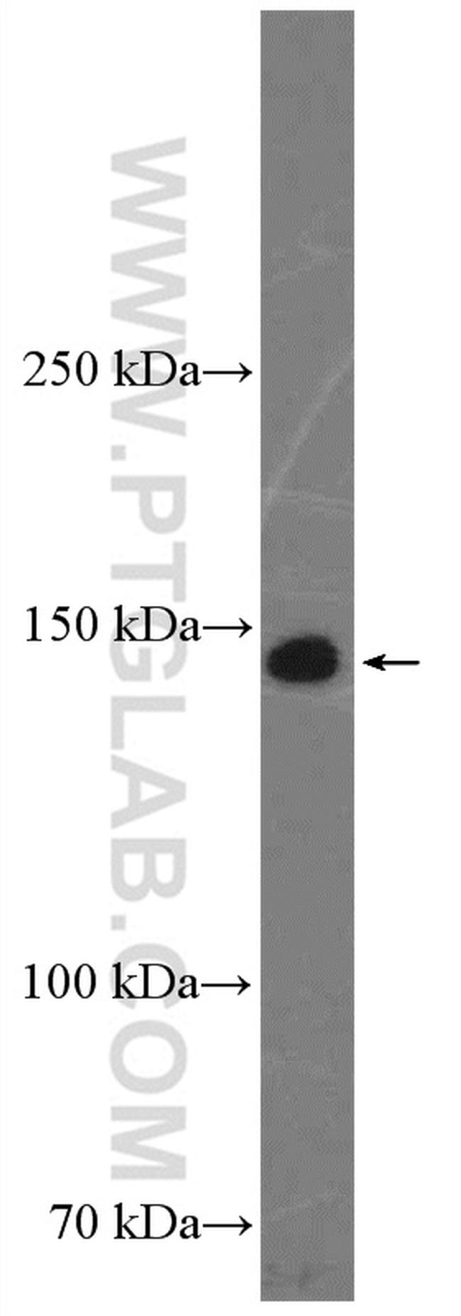 CD42b Antibody in Western Blot (WB)