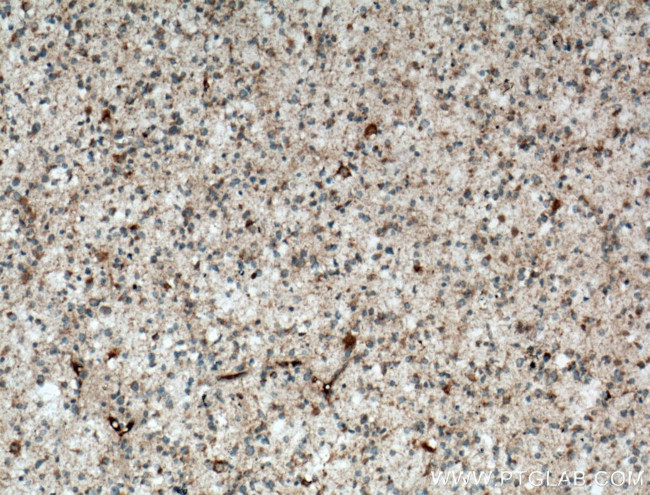 STOML1 Antibody in Immunohistochemistry (Paraffin) (IHC (P))