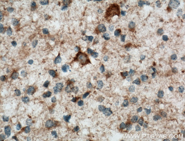 STOML1 Antibody in Immunohistochemistry (Paraffin) (IHC (P))