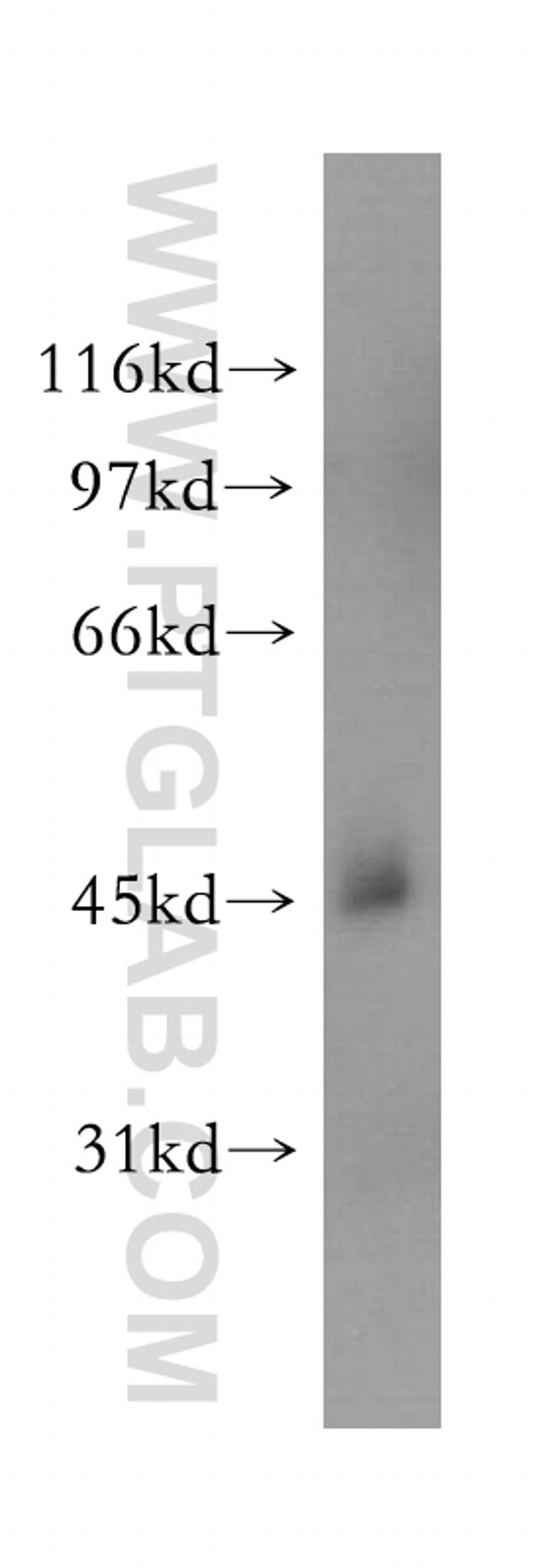 STOML1 Antibody in Western Blot (WB)