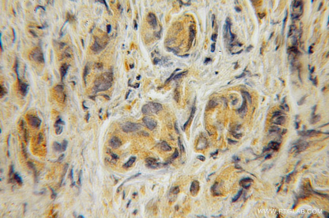 TRAF5 Antibody in Immunohistochemistry (Paraffin) (IHC (P))