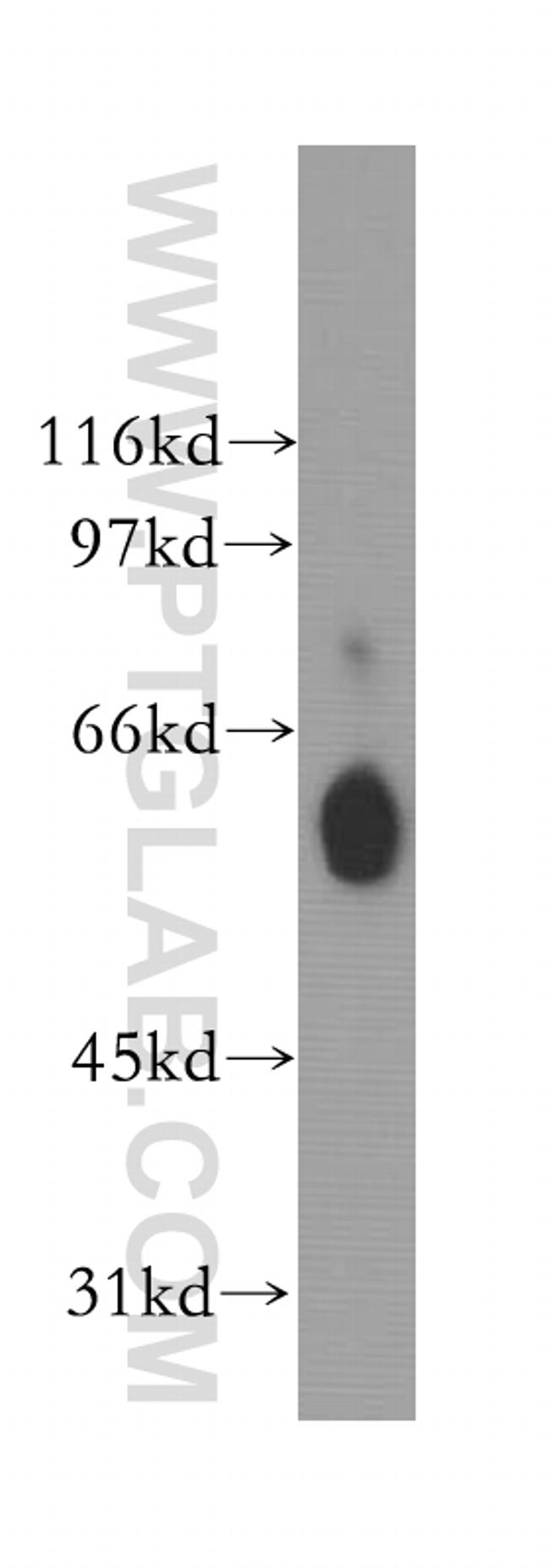 TRAF5 Antibody in Western Blot (WB)