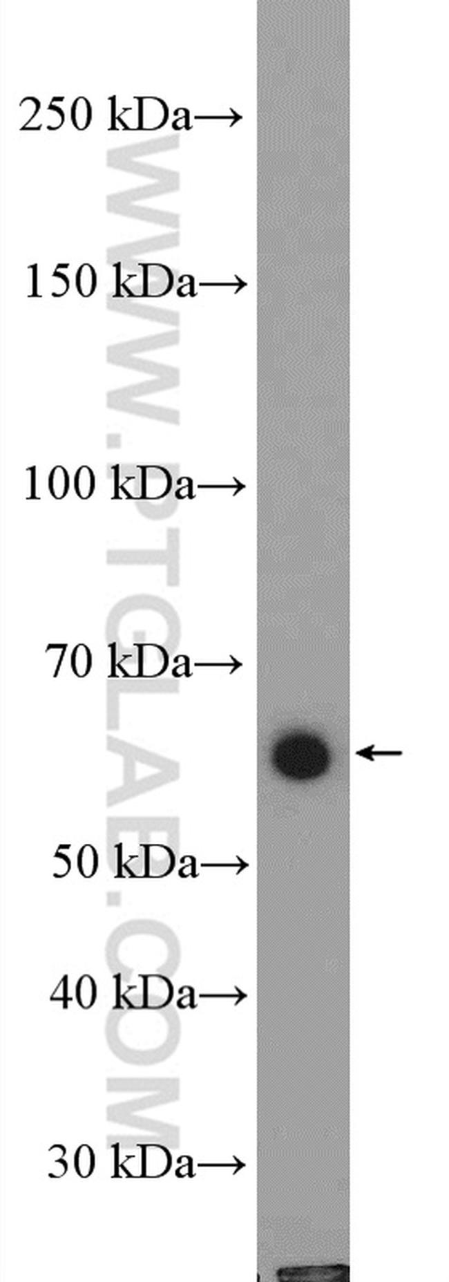 TRAF5 Antibody in Western Blot (WB)