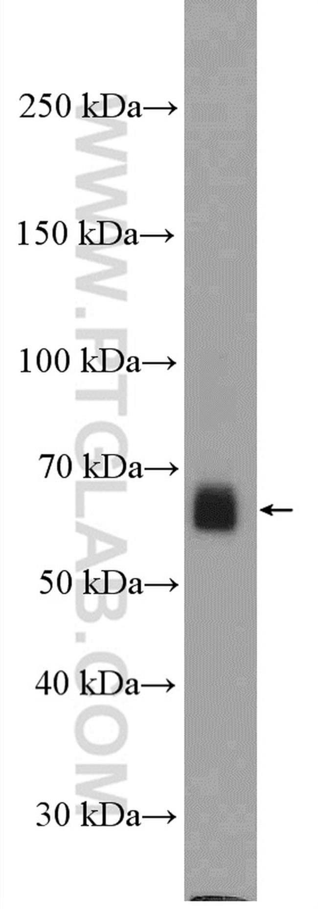 TRAF5 Antibody in Western Blot (WB)