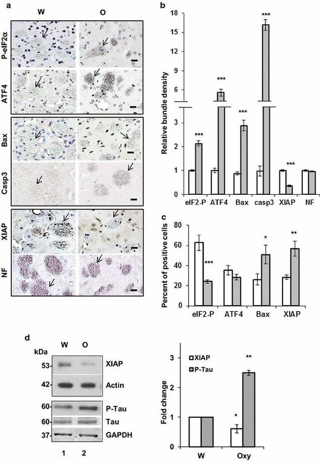 ATF4 Antibody in Immunohistochemistry (IHC)