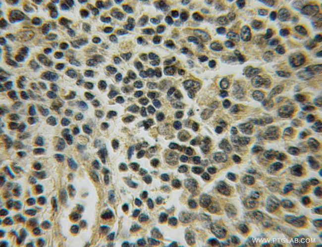 UGCG Antibody in Immunohistochemistry (Paraffin) (IHC (P))