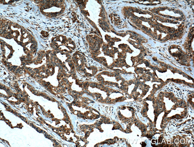 UGCG Antibody in Immunohistochemistry (Paraffin) (IHC (P))