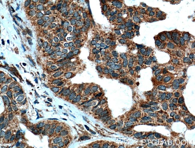 UGCG Antibody in Immunohistochemistry (Paraffin) (IHC (P))