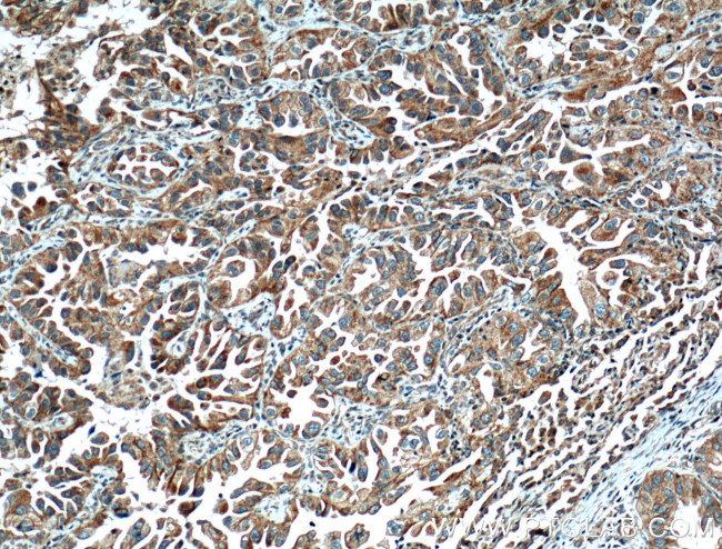 UGCG Antibody in Immunohistochemistry (Paraffin) (IHC (P))