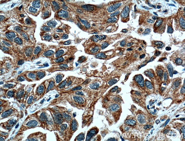 UGCG Antibody in Immunohistochemistry (Paraffin) (IHC (P))