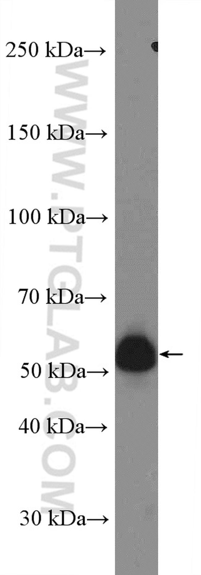 UGCG Antibody in Western Blot (WB)