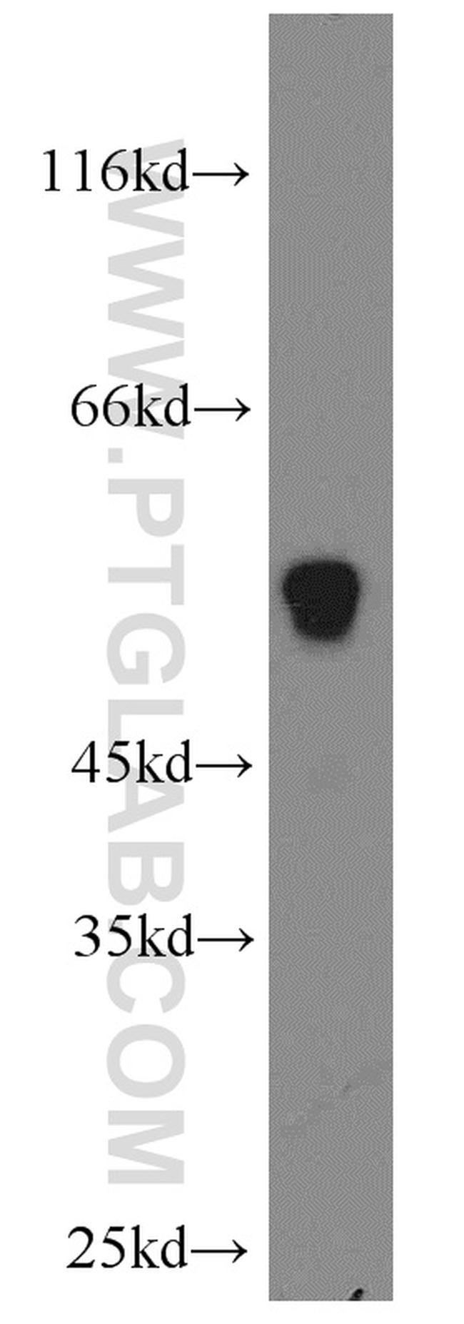 UGCG Antibody in Western Blot (WB)