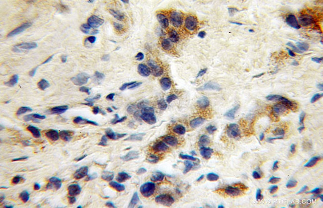 GABRG1 Antibody in Immunohistochemistry (Paraffin) (IHC (P))