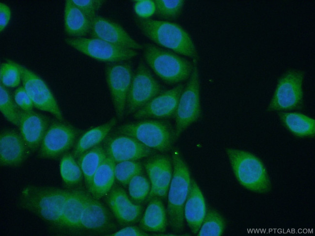 ALG1 Antibody in Immunocytochemistry (ICC/IF)