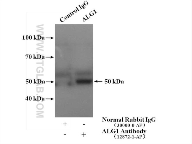 ALG1 Antibody in Immunoprecipitation (IP)