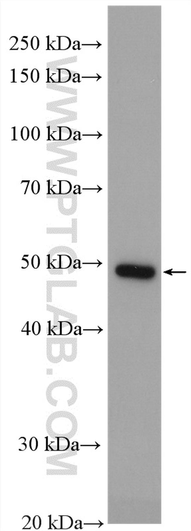 ALG1 Antibody in Western Blot (WB)