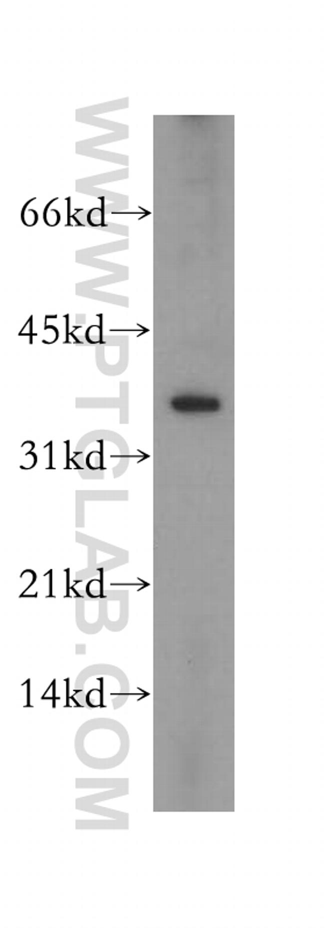 RPP38 Antibody in Western Blot (WB)