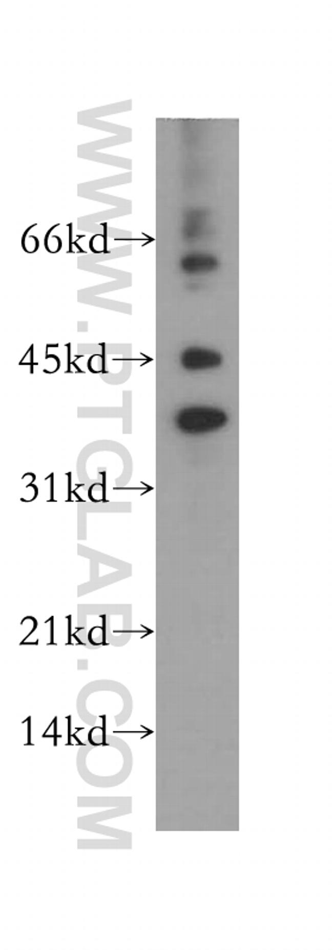 RPP38 Antibody in Western Blot (WB)