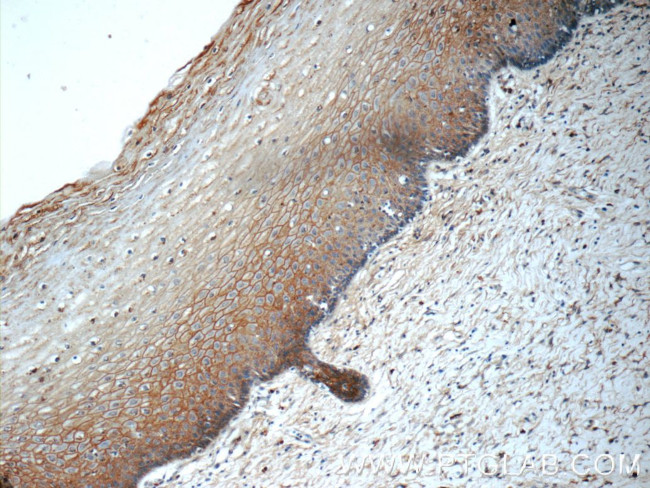 GJB3 Antibody in Immunohistochemistry (Paraffin) (IHC (P))