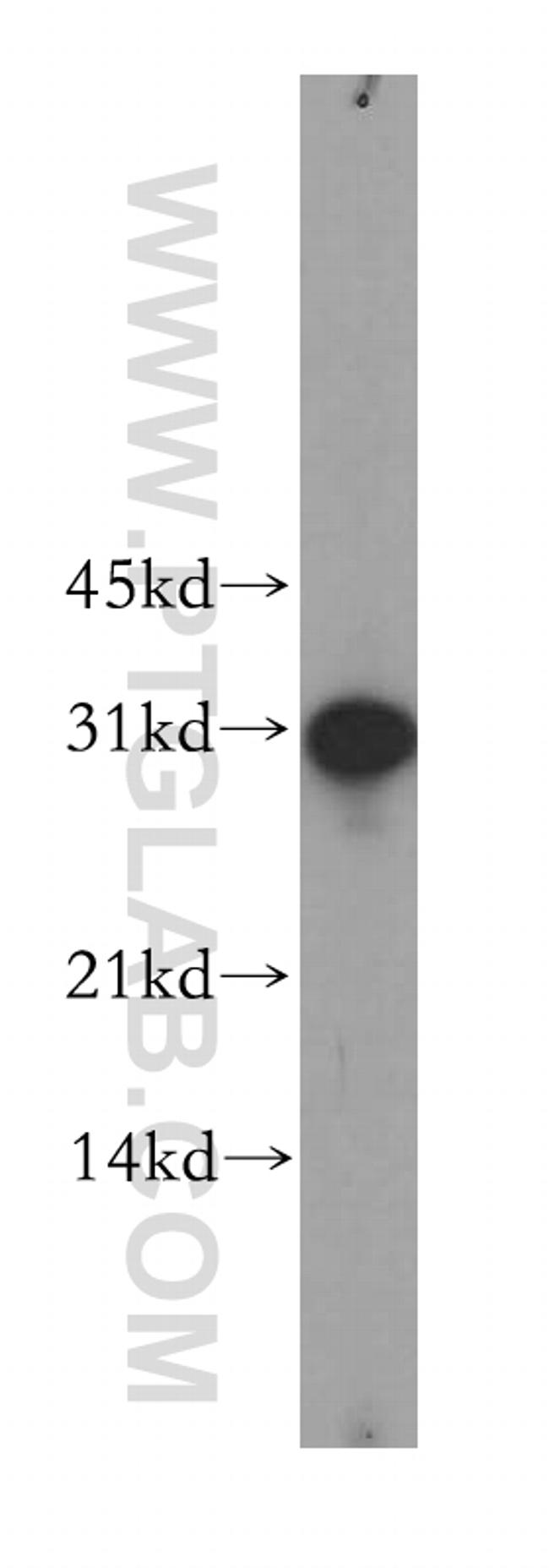 GJB3 Antibody in Western Blot (WB)