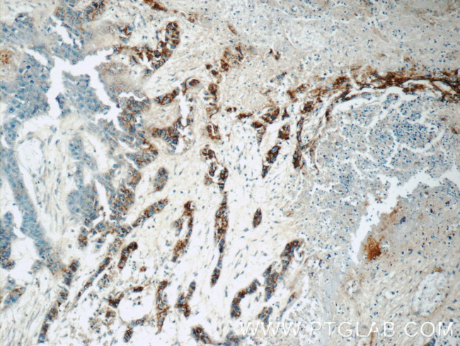 GJB3 Antibody in Immunohistochemistry (Paraffin) (IHC (P))