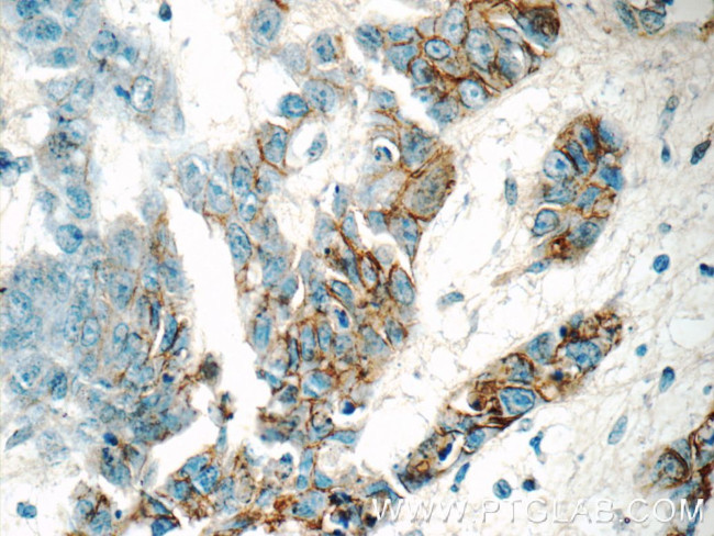 GJB3 Antibody in Immunohistochemistry (Paraffin) (IHC (P))