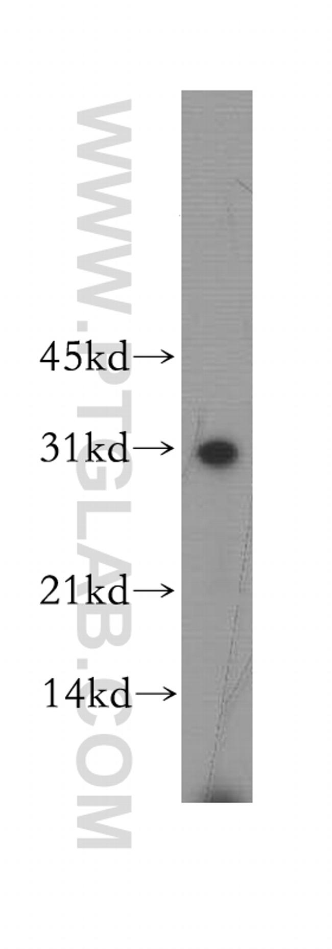 GJB3 Antibody in Western Blot (WB)