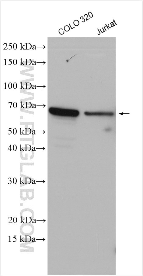 LILRB5 Antibody in Western Blot (WB)