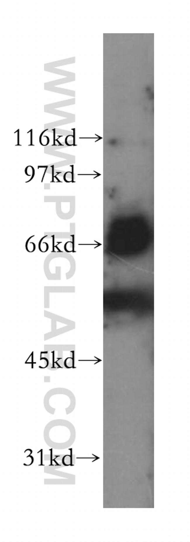 LILRB5 Antibody in Western Blot (WB)