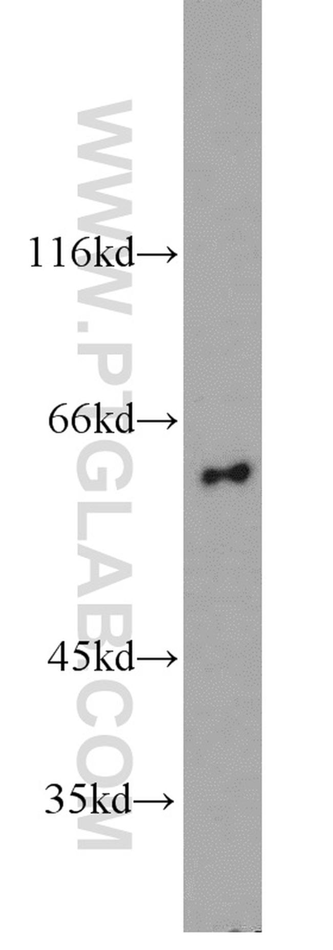 LILRB5 Antibody in Western Blot (WB)