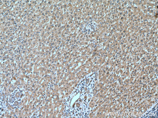 GSDMB Antibody in Immunohistochemistry (Paraffin) (IHC (P))