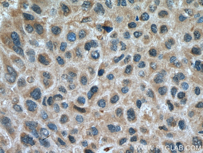 GSDMB Antibody in Immunohistochemistry (Paraffin) (IHC (P))