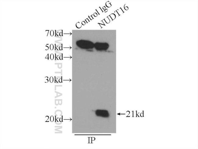 NUDT16 Antibody in Immunoprecipitation (IP)