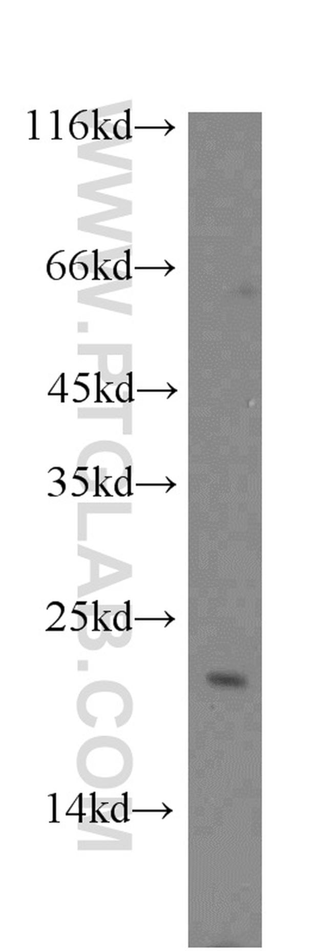 NUDT16 Antibody in Western Blot (WB)