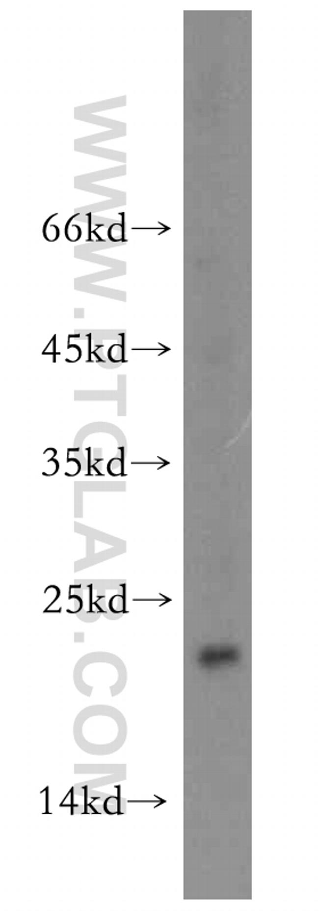 NUDT16 Antibody in Western Blot (WB)