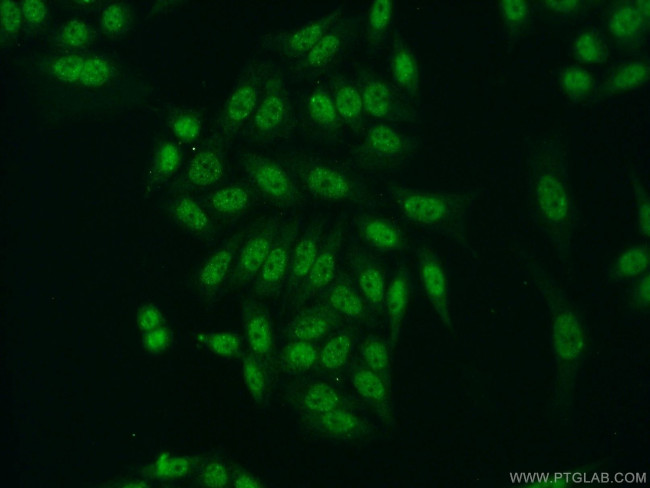 TDP-43 (C-terminal) Antibody in Immunocytochemistry (ICC/IF)