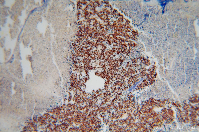 TDP-43 (C-terminal) Antibody in Immunohistochemistry (Paraffin) (IHC (P))