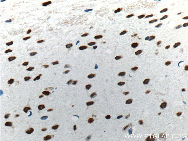 TDP-43 (C-terminal) Antibody in Immunohistochemistry (Paraffin) (IHC (P))