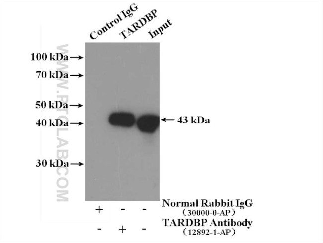 TDP-43 (C-terminal) Antibody in Immunoprecipitation (IP)